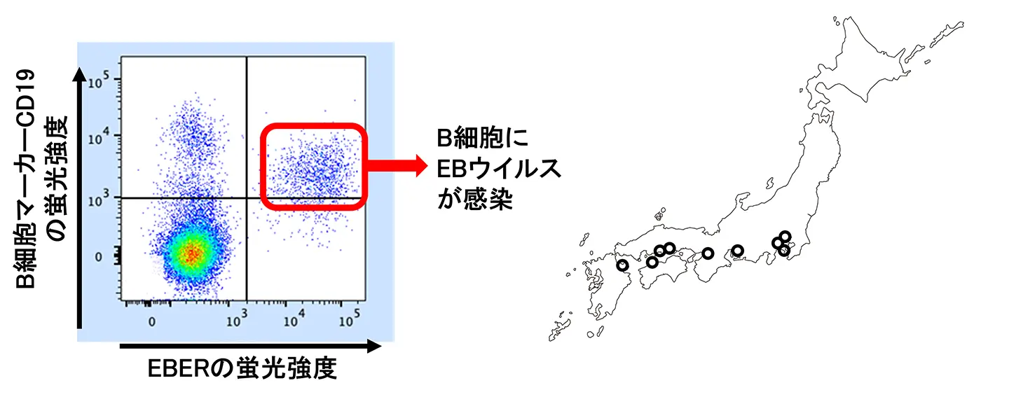 EBER flow-FISH法によるEBウイルス感染細胞の可視化と実用化