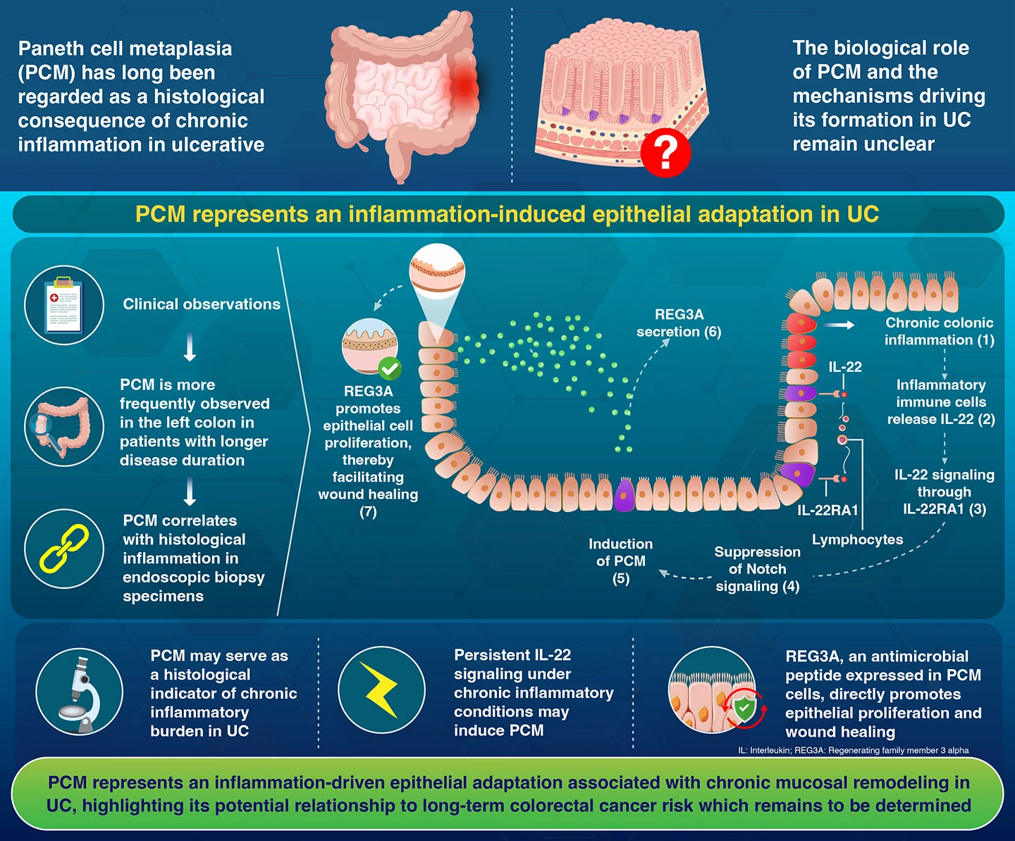 IL-22 induces Paneth cell metaplasia in the colonic epithelium of ulcerative colitis, promoting wound healing via REG3A